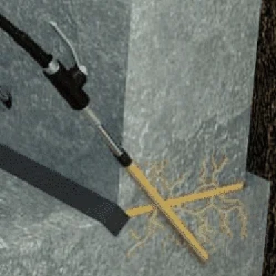 Инъекционные составы